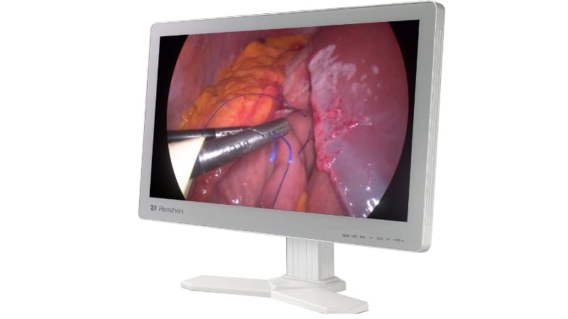 Close-up of a surgical image on a 24-inch Reshin monitor, highlighting fine tissue detail