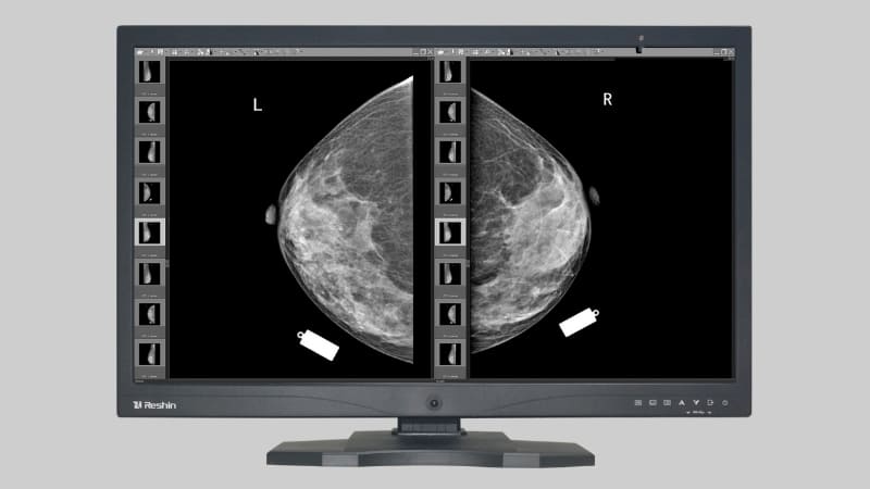 Close-up on a Reshin monitor screen showing crisp image detail and DICOM compliance mark