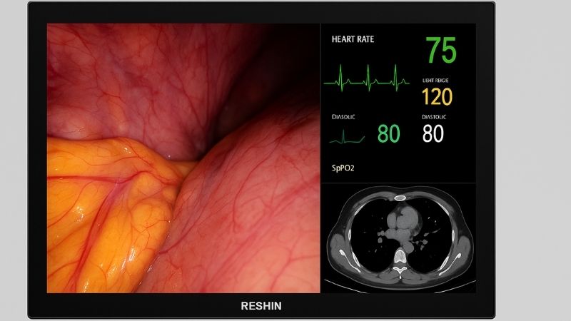 Screenshot of a 27-inch monitor displaying multiple imaging sources simultaneously