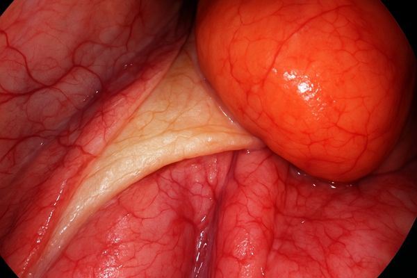 Close-up of a high-resolution endoscopic image showing fine tissue detail