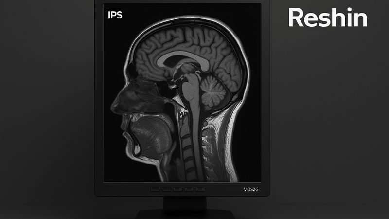 A Reshin diagnostic monitor with an IPS panel showing a clear medical image