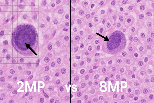 Side-by-side comparison of a cell structure on a low-resolution versus a high-resolution display