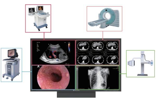 Multi-Modality Imaging Display