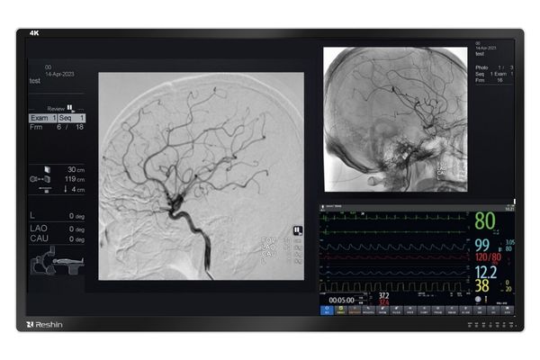 MS551 4K Medical Display for Angiography