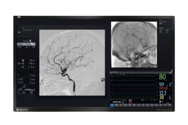 Cath Lab Monitors