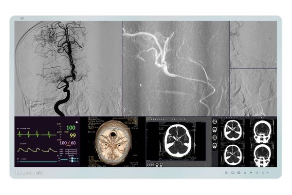 MS431P 4K Medical Display for Cath Lab