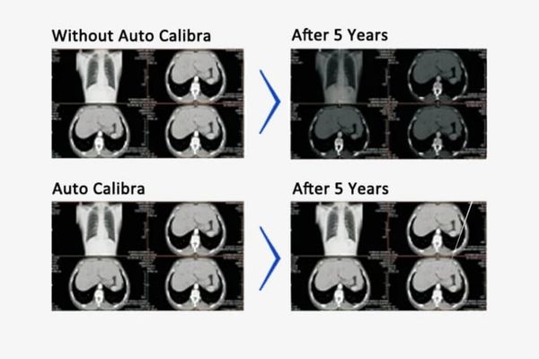 Automatic Calibration