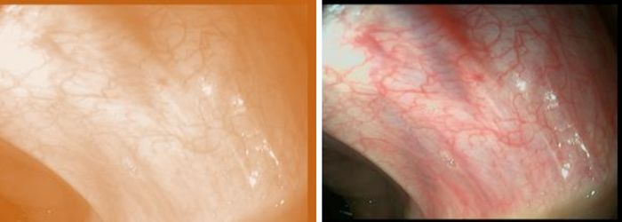 Stain Correction Technology