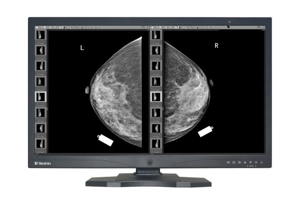 Radiology Monitors
