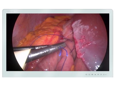 MS270P Surgical Monitor