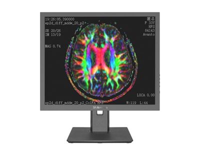 MD10C Diagnostic Medical Display