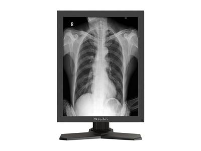 MD26GA Diagnostic Medical Display