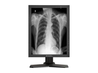 MD33G Diagnostic Medical Display