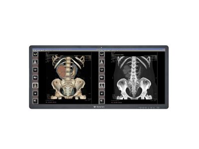MD51CHY 5MP Ultrawide Diagnostic Display
