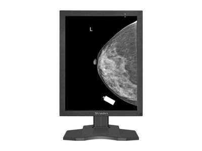 MD52G Diagnostic Mammography Display