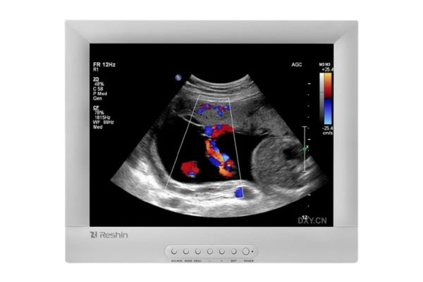 Ultrasound Monitors