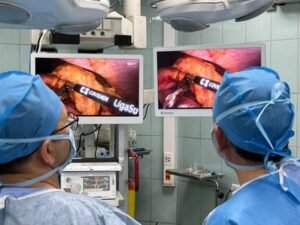 En el quirófano, monitores médicos de Reshin conectados a un sistema Richard Wolf muestran imágenes quirúrgicas laparoscópicas de alta definición mientras dos cirujanos realizan la intervención.
