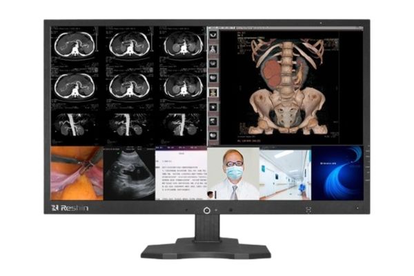 Radiotherapy Monitors