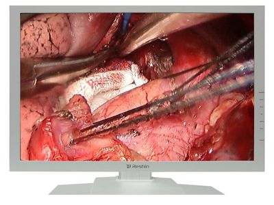 MS247SA Surgical Monitor