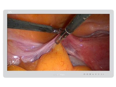 MS275P 4K Surgical Monitor
