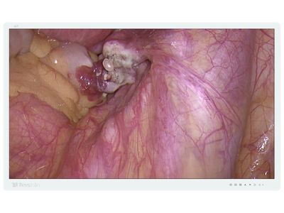 MS430PC 4K Surgical Monitor