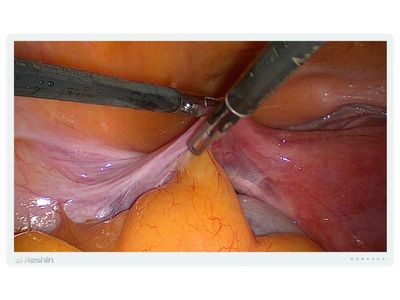 MS550P 4K Surgical Monitor