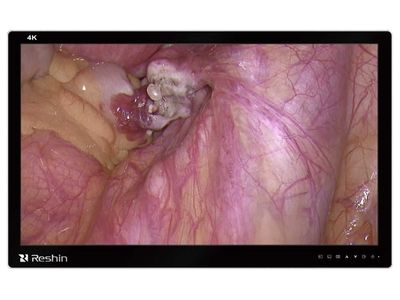 MS322PB 4K Surgical Monitor