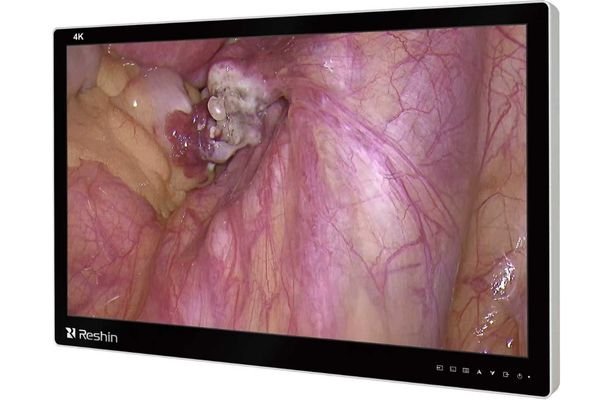 An image from an endoscope showing a clear view of tissue structures, free from any motion blur or ghosting artifacts