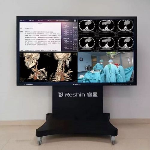 eshin mobile medical display multi window surgical imaging