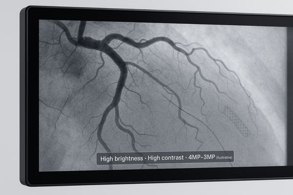 Close-up of a high-resolution cardiac image showing fine vessel details
