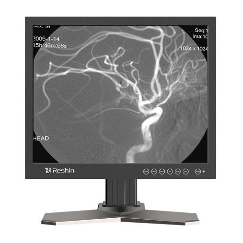 1MP DICOM Diagnostic Monitor for CT/MRI Systems | OEM Medical Display ...