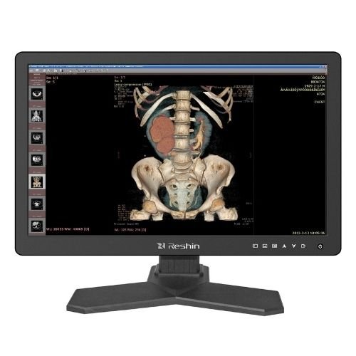 2MP DICOM Monitor for Radiology Imaging Systems | OEM Medical Display ...