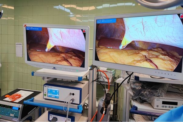Laparoscopic surgery with 27-inch FHD Surgical Monitor MS270P