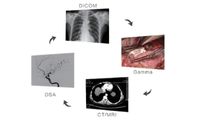 Built-in Multiple Medical Device Curves
