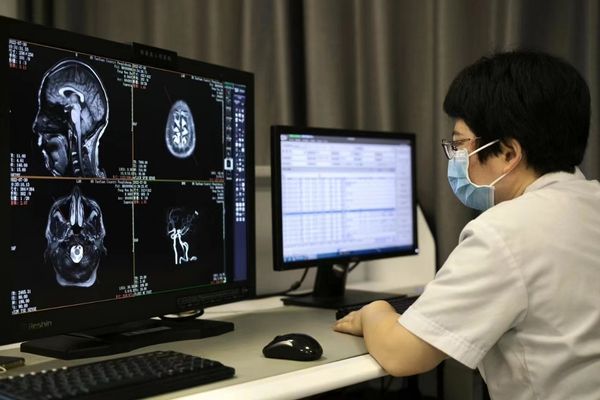 Radiologist reviewing MRI on high-resolution clinical display