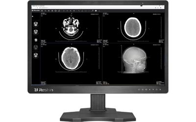 4MP diagnostic display showing cranial CT images