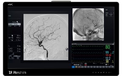 Reshin cath lab monitor displaying cerebral angiography and vital signs monitoring