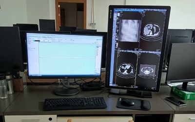 Clinical diagnostic workstation with dual monitors for CT image analysis