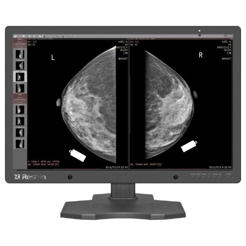 12MP Diagnostic Monitor for Mammography & PACS | Radiology Display ...