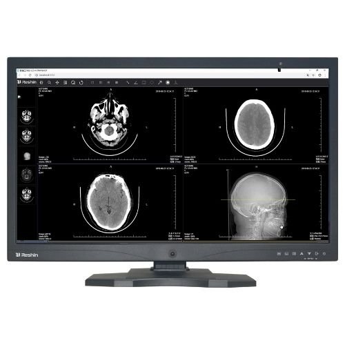 Monitor Scan 8MP Diagnostic Monitor for Multi-Modality Imaging | Medical Display ...