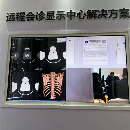reshin telemedicine display center solution