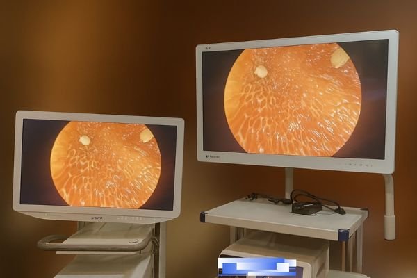 A comparison table infographic highlighting superior brightness of one monitor