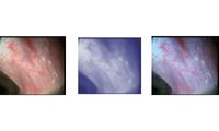 Dyeing Correction Technology