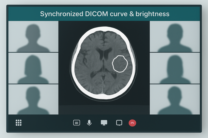A virtual meeting grid showing multiple specialists all viewing the same synchronized medical scan