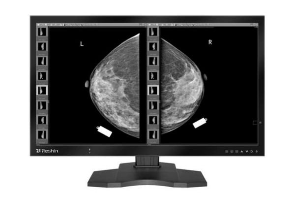 A radiologist at a PACS workstation, comparing images for PACS reading on DICOM-compliant displays (dual 5MP, mammography).