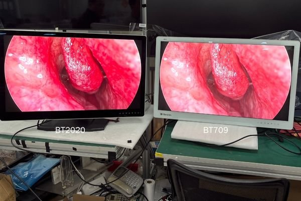 A side-by-side comparison of tissue color on a BT.709 and a BT.2020 monitor.