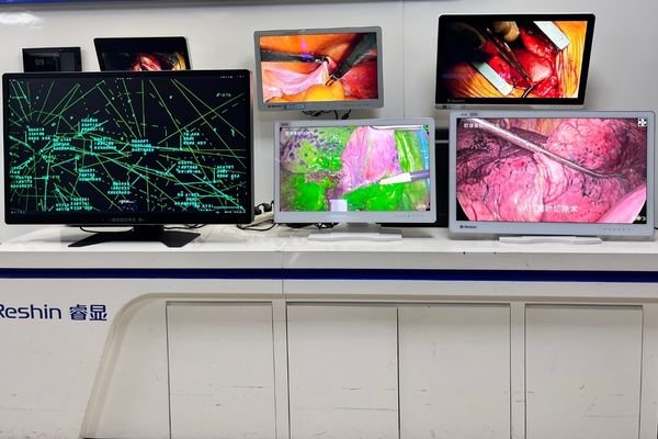 Reshin medical display product documentation and real product photos