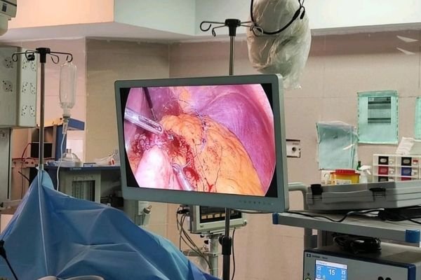 A surgeon performing MIS while viewing a clear FHD surgical monitor on a surgical boom.