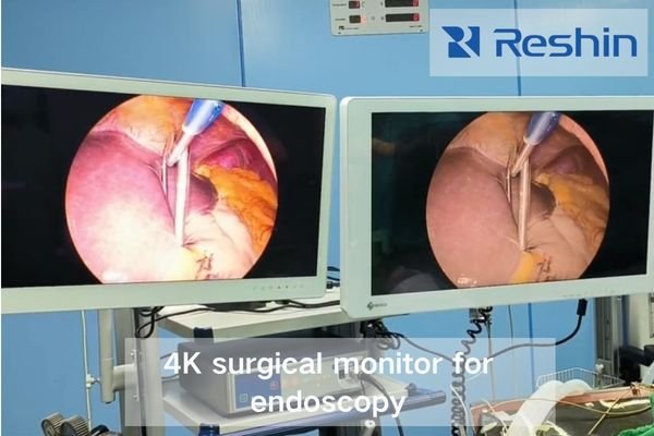 A 27-inch 4K surgical monitor showing detailed laparoscopic anatomy in vivid color.
