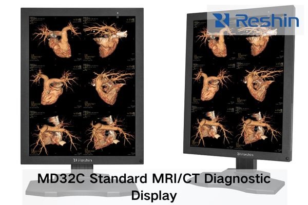 MD32C diagnostic display showing chest CT with even grayscale and clear mediastinal detail